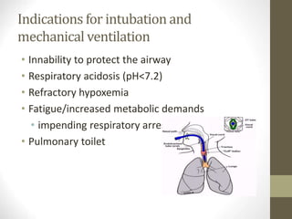 Indications for intubation and
mechanical ventilation
• Innability to protect the airway
• Respiratory acidosis (pH<7.2)
• Refractory hypoxemia
• Fatigue/increased metabolic demands
• impending respiratory arrest
• Pulmonary toilet
 