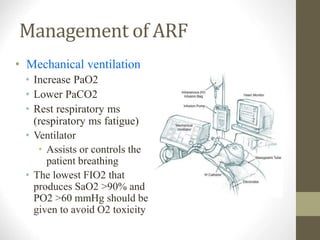 Management of ARF
• Mechanical ventilation
• Increase PaO2
• Lower PaCO2
• Rest respiratory ms
(respiratory ms fatigue)
• Ventilator
• Assists or controls the
patient breathing
• The lowest FIO2 that
produces SaO2 >90% and
PO2 >60 mmHg should be
given to avoid O2 toxicity
 