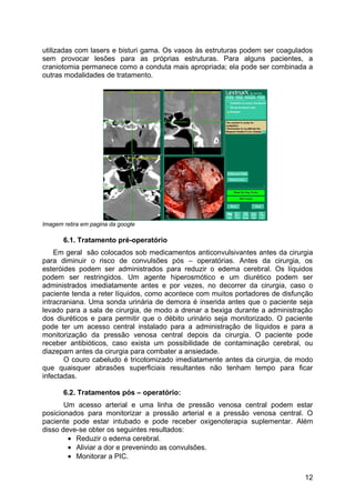 utilizadas com lasers e bisturi gama. Os vasos às estruturas podem ser coagulados
sem provocar lesões para as próprias estruturas. Para alguns pacientes, a
craniotomia permanece como a conduta mais apropriada; ela pode ser combinada a
outras modalidades de tratamento.
Imagem retira em pagina da google
6.1. Tratamento pré-operatório
Em geral são colocados sob medicamentos anticonvulsivantes antes da cirurgia
para diminuir o risco de convulsões pós – operatórias. Antes da cirurgia, os
esteróides podem ser administrados para reduzir o edema cerebral. Os líquidos
podem ser restringidos. Um agente hiperosmótico e um diurético podem ser
administrados imediatamente antes e por vezes, no decorrer da cirurgia, caso o
paciente tenda a reter líquidos, como acontece com muitos portadores de disfunção
intracraniana. Uma sonda urinária de demora é inserida antes que o paciente seja
levado para a sala de cirurgia, de modo a drenar a bexiga durante a administração
dos diuréticos e para permitir que o débito urinário seja monitorizado. O paciente
pode ter um acesso central instalado para a administração de líquidos e para a
monitorização da pressão venosa central depois da cirurgia. O paciente pode
receber antibióticos, caso exista um possibilidade de contaminação cerebral, ou
diazepam antes da cirurgia para combater a ansiedade.
O couro cabeludo é tricotomizado imediatamente antes da cirurgia, de modo
que quaisquer abrasões superficiais resultantes não tenham tempo para ficar
infectadas.
6.2. Tratamentos pós – operatório:
Um acesso arterial e uma linha de pressão venosa central podem estar
posicionados para monitorizar a pressão arterial e a pressão venosa central. O
paciente pode estar intubado e pode receber oxigenoterapia suplementar. Além
disso deve-se obter os seguintes resultados:
• Reduzir o edema cerebral.
• Aliviar a dor e prevenindo as convulsões.
• Monitorar a PIC.
12
 