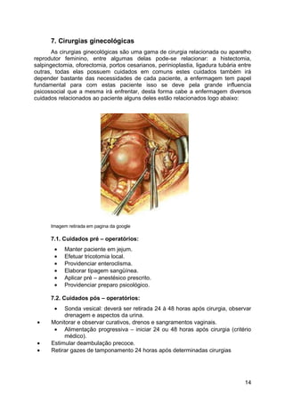 7. Cirurgias ginecológicas
As cirurgias ginecológicas são uma gama de cirurgia relacionada ou aparelho
reprodutor feminino, entre algumas delas pode-se relacionar: a histectomia,
salpingectomia, oforectomia, portos cesarianos, perinioplastia, ligadura tubária entre
outras, todas elas possuem cuidados em comuns estes cuidados também irá
depender bastante das necessidades de cada paciente, a enfermagem tem papel
fundamental para com estas paciente isso se deve pela grande influencia
psicossocial que a mesma irá enfrentar, desta forma cabe a enfermagem diversos
cuidados relacionados ao paciente alguns deles estão relacionados logo abaixo:
Imagem retirada em pagina da google
7.1. Cuidados pré – operatórios:
• Manter paciente em jejum.
• Efetuar tricotomia local.
• Providenciar enteroclisma.
• Elaborar tipagem sangüínea.
• Aplicar pré – anestésico prescrito.
• Providenciar preparo psicológico.
7.2. Cuidados pós – operatórios:
• Sonda vesical: deverá ser retirada 24 à 48 horas após cirurgia, observar
drenagem e aspectos da urina.
• Monitorar e observar curativos, drenos e sangramentos vaginais.
• Alimentação progressiva – iniciar 24 ou 48 horas após cirurgia (critério
médico).
• Estimular deambulação precoce.
• Retirar gazes de tamponamento 24 horas após determinadas cirurgias
14
 