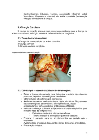 Gastrointestinais (náuseas, vômitos, constipação intestinal, sede);
Vasculares (Cianoses e edemas); da ferida operatória (hemorragia,
infecção e deiscência) e choque.
1. Cirurgia Cardíaca
A cirurgia do coração aberto é mais comumente realizada para a doença da
artéria coronariana, disfunção valvular e defeitos cardíacos congênitos.
1.1. Tipos de cirurgia cardíaca:
1-Cirurgia de “transposição” da artéria coronária.
2-Cirurgia valvular.
3-Cirurgia cardíaca congênita.
Imagem retirada em pagina do google
1.2. Conduta pré – operatória/cuidados de enfermagem:
• Rever a doença do paciente para determinar o estado dos sistemas
pulmonar, hepático, hematológico e metabólico.
• Obter estudos laboratoriais pré-operatórios.
• Avaliar os esquemas medicamentosos; digital, diuréticos, Bloqueadores
beta-adrenergicos, psicotrópicos, anti-hipertensivos, álcool,
anticoagulantes, corticosteróides, antibióticos profiláticos.
• Melhorar a doença pulmonar subjacente e a função respiratória para
reduzir o risco de complicações.
- Estimular o paciente a interromper o fumo.
- Tratar a infecção e a congestão pulmonar vascular.
• Preparar o paciente para os acontecimentos no período pós –
operatório.
• Avaliar estado emocional do paciente e tentar diminuir as ansiedades.
• Preparação cirúrgica.
4
 