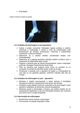 • Amputação
Imagem retirada em página da google
2.2. Cuidados de enfermagem no pré-operatório
• Avaliar o estado nutricional: hidratação ingesta protéica e calórica
maximizar a cicatrização e reduzir o risco de complicações pelo
fornecimento de líquidos intravenosos, vitaminas e suplementos
nutricionais, conforme indicado.
• Determinar se a pessoa recebeu previamente terapia com
corticosteróides.
• Determinar se a pessoa apresenta infecção poderia contribuir para o
surgimento de osteomielite após cirugia.
• Preparar o paciente para as rotinas pré-operatórias: tosse e respiração
profunda, checagem freqüente dos sinais vitais.
• Pedir ao paciente que pratique como urinar na comadre ou no
compadre na posição de decúbito dorsal, antes da cirurgia.
• Familiarizar o paciente com o aparelho de tração e a necessidade de
uma tala ou um aparelho gessado, conforme indicado pelo tipo de
cirurgia
2.3. Cuidados de enfermagem no pós – operatório:
• Monitorar o estado neurovascular e tentar eliminar a tumefação
causada por edema e sangramento para dentro dos tecidos.
• Imobilizar a área afetada e eliminar a atividade a fim de proteger o local
operado e estabilizar as estruturas músculo esqueléticas.
• Monitorar quanto a hemorragia e choque, que podem resultar de um
sangramento significativo e de uma hemostasia precária dos músculos
que ocorre com a cirurgia ortopédica.
2.4. Intervenções de enfermagem
• Monitorando quanto choque e hemorragia
• Promovendo um padrão respiratório eficaz
6
 