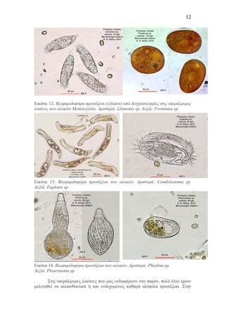 12
Εικόνα 12. Βλεφαριδοφόρα πρωτόζωα (ciliates) από δειγµατοληψίες στις υπεράλµυρες
λεκάνες των αλυκών Μεσολογγίου. Αριστερά: Litonotus sp. Δεξιά: Frontonia sp.
Εικόνα 13. Βλεφαριδοφόρα πρωτόζωα των αλυκών. Αριστερά: Condylostoma sp.
Δεξιά: Euplotes sp
Εικόνα 14. Βλεφαριδοφόρα πρωτόζωα των αλυκών. Αριστερά: Phialina sp.
Δεξιά: Pleuronema sp.
. Στις υπεράλµυρες λεκάνες που µας ενδιαφέρουν στο παρόν, πολύ λίγο έχουν
µελετηθεί τα αλοανθεκτικά ή και ενδεχοµένως καθαρά αλόφιλα πρωτόζωα. Στην
 