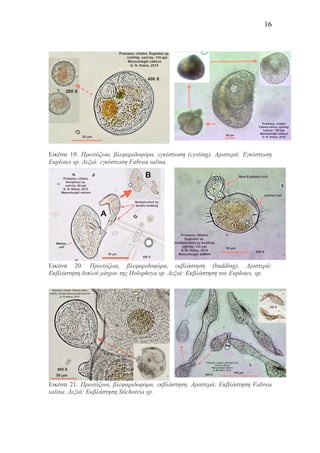 16
Εικόνα 19. Πρωτόζωα, βλεφαριδοφόρα, εγκύστωση (cysting). Αριστερά: Εγκύστωση
Euplotes sp. Δεξιά: εγκύστωση Fabrea salina.
Εικόνα 20. Πρωτόζωα, βλεφαριδοφόρα, εκβλάστηση (budding). Αριστερά:
Εκβλάστηση διπλού µίσχου της Holophrya sp. Δεξιά: Εκβλάστηση του Euplotes. sp.
Εικόνα 21. Πρωτόζωα, βλεφαριδοφόρα, εκβλάστηση. Αριστερά: Εκβλάστηση Fabrea
salina. Δεξιά: Εκβλάστηση Stichotria sp.
 