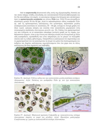 19
Από τα καρκινοειδή πλαγκτονικά είδη, εκτός της αλµυρογαρίδας Artemia για
την οποία υπάρχει πλήθος αλλοδαπής και ικανοποιητική Ελληνική βιβλιογραφία και
δεν θα επεκταθούµε στο παρόν, το καινούργιο εύρηµα στα δείγµατα που εξετάστηκαν
ήταν το αρπακτικοειδές κωπήποδο του γένους Tisbe (εικ. 24 & 25) και ανευρέθη σε
αλατότητες µεταξύ 50 και 80 ppt. Αυτό το απροσδιορίστου είδους κωπήποδο Tisbe
sp., από τις προκαταρκτικές καλλιέργειες στο εργαστήριο, παρουσίασε µεγάλη
αναπαραγωγική ικανότητα σε αλατότητες 30 – 60 ppt, αντοχή σε συνεχή χρήση του
ίδιου νερού, γρήγορη αύξηση και ευκολία στην κατανάλωση µικροφυκών (στη
συγκεκριµένη περίπτωση Asteromonas gracilis–εικ. 26). Επίσης ένα χαρακτηριστικό
του που ενδέχεται να το καταστήσει υποψήφια ζωντανή τροφή για τις νύµφες των
θαλασσινών ψαριών, είναι η όχι έντονη και απότοµη κίνησή του (συγκριτικά µε άλλα
είδη κωπηπόδων), προϋπόθεση που είναι απαραίτητη για να µπορεί να συλληφθεί
εύκολα από τις νωθρές ιχθυονύµφες. Επιπρόσθετα η καλλιέργειά του παρουσιάζει και
το χαρακτηριστικό του να κατανέµονται τα άτοµά του µέσα στα συσσωµατώµατα του
πυθµένα του δοχείου καλλιέργειας εκµεταλλευόµενα έτσι ένα χώρο που σε άλλες
καλλιέργειες θα ήταν άχρηστος και επιβλαβής.
Εικόνα 26. Αριστερά: Fabrea salina που έχει καταναλώσει µεγάλη ποσότητα κυττάρων
Αστεροµονας. Δεξιά: Ναύπλιος του κωπηπόδου Tisbe sp. που έχει καταναλώσει
Asteromonas.
Εικόνα 27. Αριστερά: Μαστιγωτό πρώτιστο Colpodella sp. καταναλώνοντας κύτταρα
Asteromonas (παρόλο το µικρό του µέγεθος). Δεξιά: Πρωτόζωο µαστιγοφόρο
Condylostoma sp. γεµάτο µε καταναλωθέντα κύτταρα Asteromonas.
 