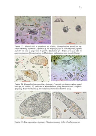 23
Εικόνα 33. Μερικά από τα µικρότερα σε µέγεθος βλεφαριδοφόρα πρωτόζωα της
υπεραλατότητας. Αριστερά: Aspidisca sp. σε δείγµα µαζί µε το µεγαλύτερο σε µέγεθος
Euplotes sp. και το µικρότερο σε µέγεθος Cyclidium sp. Δεξιά: Ενα άλλο από τα
µικροσκοπικότερα βλεφαριδοφόρα, το Halteria sp. από διαφορετικές πλευρές θέασης.
Εικόνα 34. Βλεφαριδοφόρα πρωτόζωα. Αριστερά: Frontonia sp. διαφορετική σε µορφή
από την της εικόνας 12, ανάµεσα σε κυανοπράσινα φύκη σφαιρικού και επιµήκους
σχήµατος. Δεξιά: Vorticella sp. και αυτή ανάµεσα σε κυανοπράσινα φύκη.
Εικόνα 35. Βλεφ. πρωτόζωα. Αριστερά: Climatostomum sp. Δεξιά: Condylostoma sp.
 