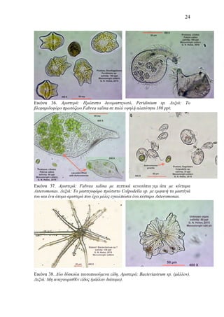 24
Εικόνα 36. Αριστερά: Πρώτιστο δινοµαστιγωτό, Gymnodinium sp. Δεξιά: Το
βλεφαριδοφόρο πρωτόζωο Fabrea salina σε πολύ υψηλή αλατότητα 180 ppt.
Εικόνα 37. Αριστερά: Fabrea salina µε πεπτικά κενοτόπια γεµ άτα µε κύτταρα
Asteromonas. Δεξιά: Το µαστιγοφόρο πρώτιστο Colpodella sp. µε εµφανή τα µαστίγιά
του και ένα άτοµο αριστερά που έχει µόλις εγκολπώσει ένα κύτταρο Asteromonas.
Εικόνα 38. Δύο δύσκολα ταυτοποιούµενα είδη. Αριστερά: Bacteriastrum sp. (µάλλον).
Δεξιά: Μη αναγνωρισθέν είδος (µάλλον διάτοµο).
 