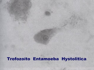 Trofozoíto Entamoeba Hystolitica 
 