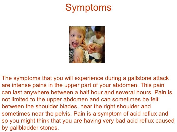 Acid Reflux Caused by Gallbladder Stones: A Misconception