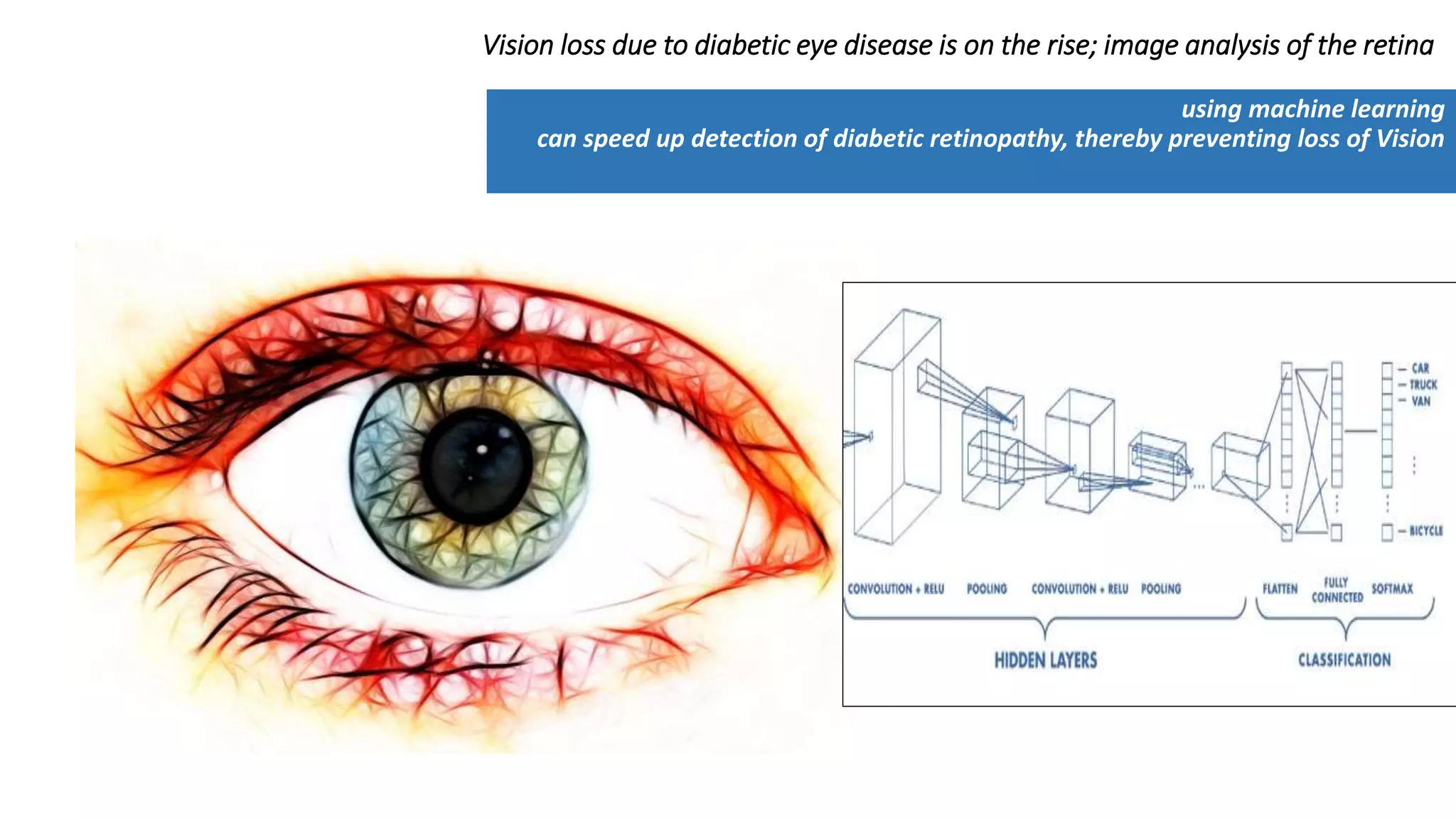 Vision loss due to diabetic eye disease is on the rise; image analysis of the retina
using machine learning
can speed up detection of diabetic retinopathy, thereby preventing loss of Vision
 