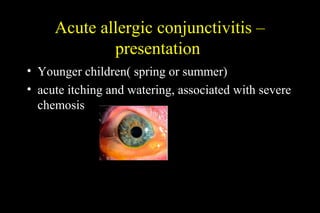 Acute allergic conjunctivitis –
presentation
• Younger children( spring or summer)
• acute itching and watering, associated with severe
chemosis
 