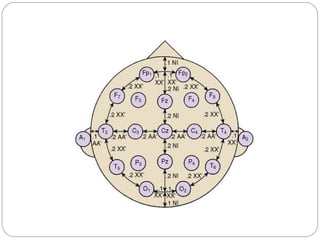 Eeg Electrode Placement 10 20 System