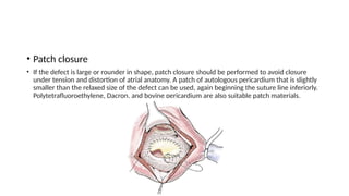 Patching Defect 10 – Atrial septal defects Zeeshan.pptx
