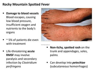 Rash Of Rmsf 10 bio265 disease of skin and cns instructor dr di bonaventura | PDF