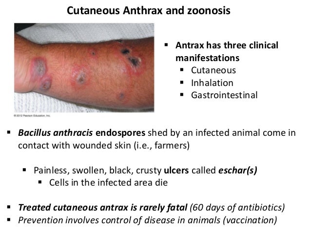 10 bio265 disease of skin and cns instructor dr di bonaventura