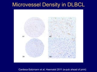 Antoni van Leeuwenhoek (1632-1723)Invented the microscope around 166821
