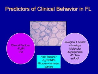 Lenz et al., N. Engl. J. Med. 2008A study of the Lymphoma Leukemia Molecular Profiling Project (LLMPP)