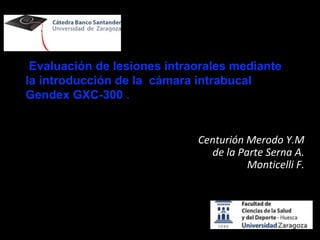 Evaluación de lesiones intraorales mediante
la introducción de la cámara intrabucal
Gendex GXC-300 .
.
Centurión Merodo Y.M
de la Parte Serna A.
Monticelli F.
 