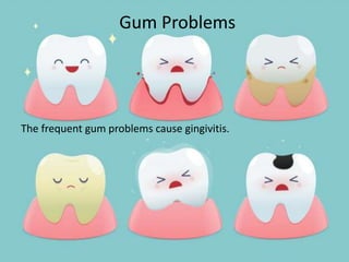 Gum Problems
The frequent gum problems cause gingivitis.
 
