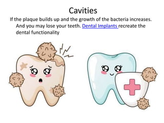 Cavities
If the plaque builds up and the growth of the bacteria increases.
And you may lose your teeth. Dental Implants recreate the
dental functionality
 
