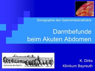 Sonographie des Gastrointestinaltrakts
Darmbefunde
beim Akuten Abdomen
K. Dirks
Klinikum Bayreuth
 