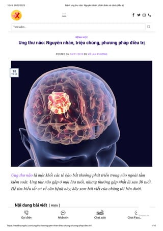 10:43, 09/02/2023 Bệnh ung thư não: Nguyên nhân, chẩn đoán và cách điều trị
https://healthyungthu.com/ung-thu-nao-nguyen-nhan-trieu-chung-phuong-phap-dieu-tri/ 1/16
Ung thư não: Nguyên nhân, triệu chứng, phương pháp điều trị
POSTED ON 18/11/2019 BY VÕ LAN PHƯƠNG
Ung thư não là một khối các tế bào bất thường phát triển trong não ngoài tầm
kiểm soát. Ung thư não gặp ở mọi lứa tuổi, nhưng thường gặp nhất là sau 30 tuổi.
Để tìm hiểu tất cả về căn bệnh này, hãy xem bài viết của chúng tôi bên dưới.
Nội dung bài viết [ Hiện ]
BỆNH HỌC
18
Th11
Tìm kiếm… 
    
Gọi điện Nhắn tin Chat zalo Chat Facebook
Contact us
 