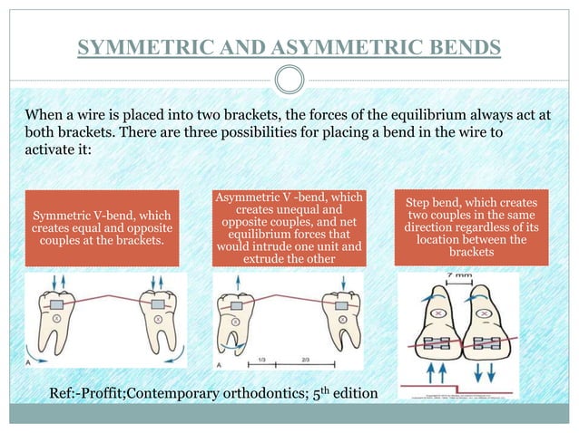 determinate vs indeterminate force system | PPTX | Dental Health ...