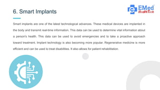 Smart implants are one of the latest technological advances. These medical devices are implanted in
the body and transmit real-time information. This data can be used to determine vital information about
a person's health. This data can be used to avoid emergencies and to take a proactive approach
toward treatment. Implant technology is also becoming more popular. Regenerative medicine is more
efficient and can be used to treat disabilities. It also allows for patient rehabilitation.
6. Smart Implants
5KG
 