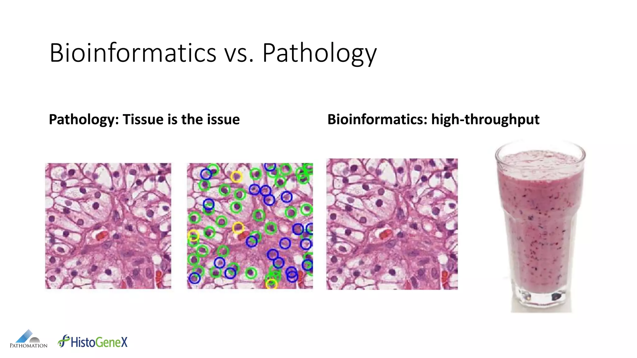 Bioinformatics vs. Pathology
Pathology: Tissue is the issue Bioinformatics: high-throughput
 