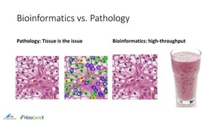Bioinformatics vs. Pathology
Pathology: Tissue is the issue Bioinformatics: high-throughput
 