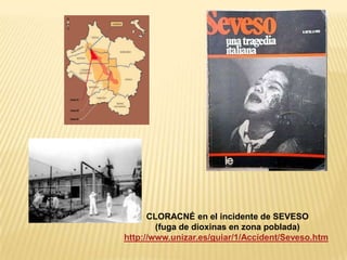 CLORACNÉ en el incidente de SEVESO
(fuga de dioxinas en zona poblada)
http://www.unizar.es/guiar/1/Accident/Seveso.htm
 