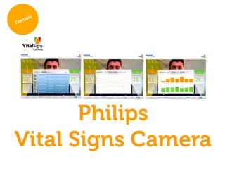 Philips
Vital Signs Camera
 