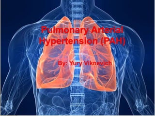Pulmonary Arterial
Hypertension (PAH)
By: Yury Viknevich
 