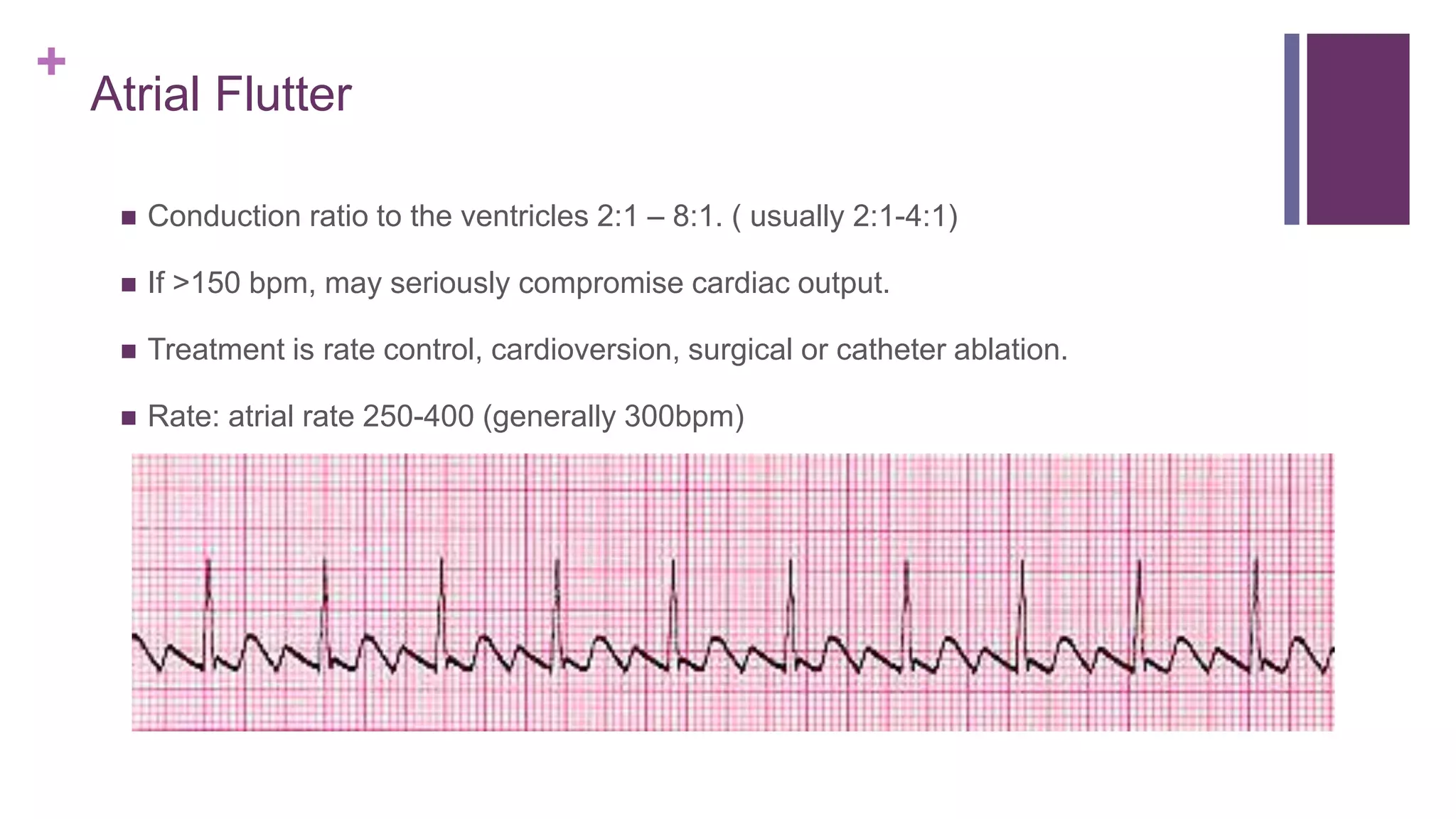 10 ECG interpret topic 10.pptx