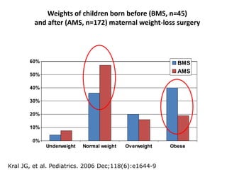 Weights of children born before (BMS, n=45)
and after (AMS, n=172) maternal weight-loss surgery
0%
10%
20%
30%
40%
50%
60%
Underweight Normal weight Overweight Obese
BMS
AMS
Kral JG, et al. Pediatrics. 2006 Dec;118(6):e1644-9
 