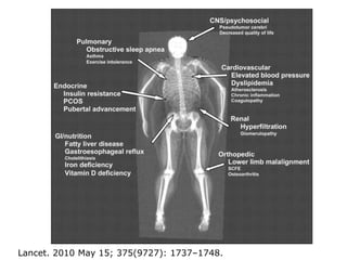 Lancet. 2010 May 15; 375(9727): 1737–1748.
 