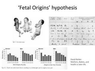 ‘Fetal Origins’ hypothesis
David Barker.
Mothers, Babies, and
health in later life.
 