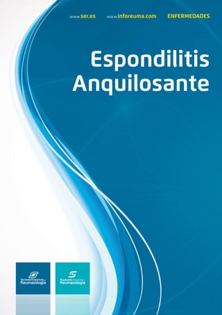 www.ser.es www.inforeuma.com ENFERMEDADES
Espondilitis
Anquilosante
 