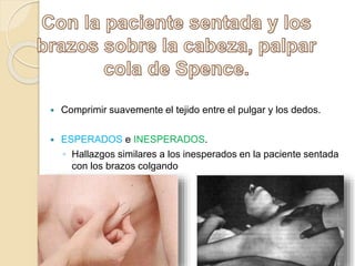  Comprimir suavemente el tejido entre el pulgar y los dedos.
 ESPERADOS e INESPERADOS.
◦ Hallazgos similares a los inesperados en la paciente sentada
con los brazos colgando
 