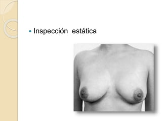  Inspección estática
 