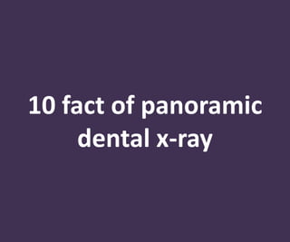 10 fact of panoramic
dental x-ray
 