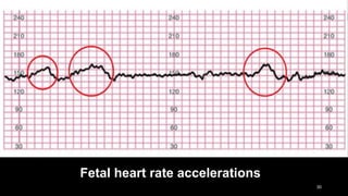 Fetal assessment | PPTX