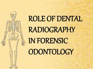 ROLE OF DENTAL
RADIOGRAPHY
IN FORENSIC
ODONTOLOGY
 