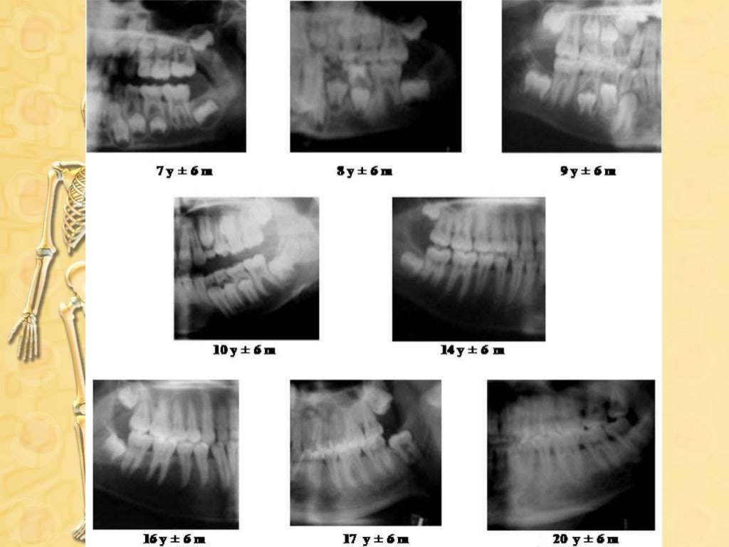 Role of Dental Radiography in Forensic Odontology