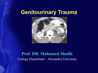 Genitourinary Trauma
Prof. DR. Mohamed ShafikProf. DR. Mohamed Shafik
Urology Department – Alexandria University
 