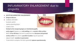 INFLAMMATORY ENLARGEMENT due to
gingivitis
 ACUTE INFLAMMATORY ENLARGEMENT
 Gingival Abscess
 CLINICAL FEATURES
- localized, painful
- rapidly expanding lesion
- sudden onset
- limited to the marginal gingiva or interdental papilla.
- early stages appears as a red swelling with a smooth, shiny surface.
- Within 24 to 48 hours, the lesion usually becomes fluctuant and pointed
- surface orifice from which a purulent exudate may be expressed.
- adjacent teeth– sensitive to percussion.
- If permitted to progress, the lesion generally ruptures spontaneously.
 