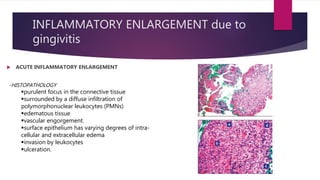 INFLAMMATORY ENLARGEMENT due to
gingivitis
 ACUTE INFLAMMATORY ENLARGEMENT
- ETIOLOGY:
- mechanical/chemical/physical irritation
- resolved by removal of irritant—main etiologic factor is trauma
(toothbrushing, etc.)
- Enlargement may result from chronic or acute inflammatory
changes
- Inflammatory enlargements usually are a secondary complication to
any of the other types of enlargement, creating a combined
gingival enlargement.
- double etiology-- treat them adequately.
-HISTOPATHOLOGY
purulent focus in the connective tissue
surrounded by a diffuse infiltration of
polymorphonuclear leukocytes (PMNs)
edematous tissue
vascular engorgement.
surface epithelium has varying degrees of intra-
cellular and extracellular edema
invasion by leukocytes
ulceration.
 