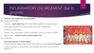  CHRONIC INFLAMMATORY ENLARGEMENT
 CLINICAL FEATURES
- originates : slight ballooning of the inter-dental papilla and marginal gingiva.
- early stage: life preserver-shaped bulge around the involved teeth.
- localized or generalized
- Progress: slow and painless, unless complicated by acute infection or trauma
- Occasionally-- discrete sessile or pedunculated mass
 ETIOLOGY
- prolonged exposure to dental plaque.
- Factors that favor plaque accumulation and retention including poor oral hygiene
- irritation by anatomic abnormalities and improper restorative and orthodontic
appliances.
INFLAMMATORY ENLARGEMENT due to
gingivitis
 