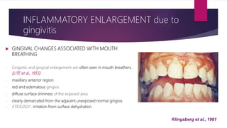  GINGIVAL CHANGES ASSOCIATED WITH MOUTH
BREATHING
- Gingivitis and gingival enlargement are often seen in mouth breathers.
[LITE et al., 1955]
- maxillary anterior region
- red and edematous gingiva
- diffuse surface shininess of the exposed area.
- clearly demarcated from the adjacent unexposed normal gingiva.
- ETIOLOGY : irritation from surface dehydration.
Klingsberg et al., 1961
INFLAMMATORY ENLARGEMENT due to
gingivitis
 