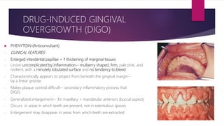  PHENYTOIN (Anticonvulsant)
- CLINICAL FEATURES:
- Enlarged interdental papillae + ↑ thickening of marginal tissues
- Lesion uncomplicated by inflammation-- mulberry shaped, firm, pale pink, and
resilient, with a minutely lobulated surface and no tendency to bleed.
- Characteristically appears to project from beneath the gingival margin--
by a linear groove.
- Makes plaque control difficult-- secondary inflammatory process that
DIGO.
- Generalized enlargement-- ↑in maxillary + mandibular anteriors (buccal aspect)
- Occurs in areas in which teeth are present, not in edentulous spaces
- Enlargement may disappear in areas from which teeth are extracted
DRUG-INDUCED GINGIVAL
OVERGROWTH (DIGO)
 